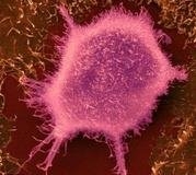 کشف آنزیم کلیدی موثر در توقف سلول‌های سرطانی 